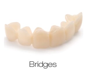 bridges
