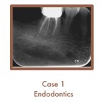 Endodontics Case Study