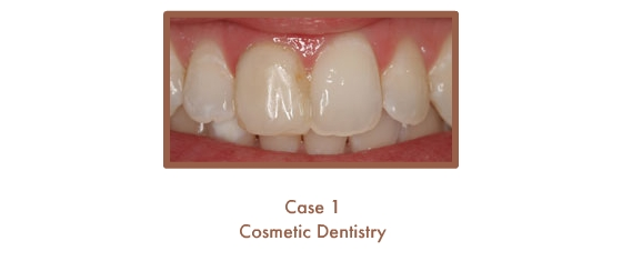 Before image