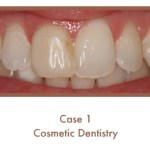 Before image