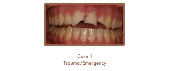Before image of a dental emergency