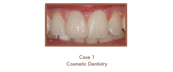 After image