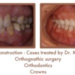 Reconstruction Case Study