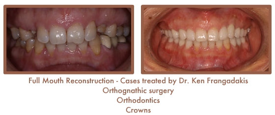 Reconstruction Case Study