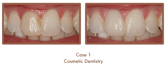 Case Study