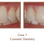 Case Study