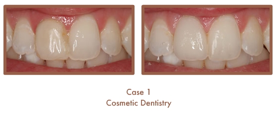 Case Study