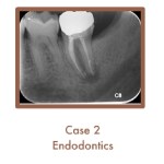 Endodontics Case Study