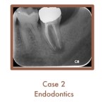 Endodontics Case Study