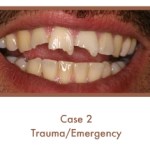 Before image of a dental emergency
