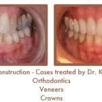 Reconstruction Case Study