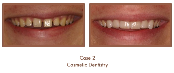 Case Study Image
