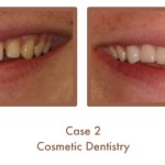 Case Study Image