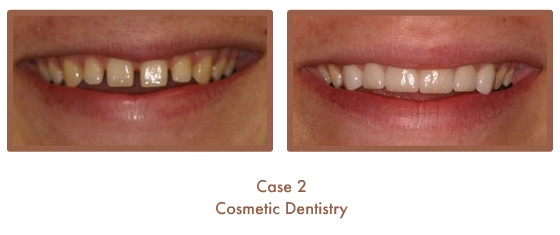 Case Study Image
