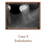 Endodontics Case Study