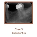 Endodontics Case Study