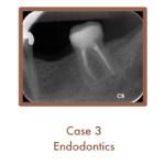 Endodontics Case Study