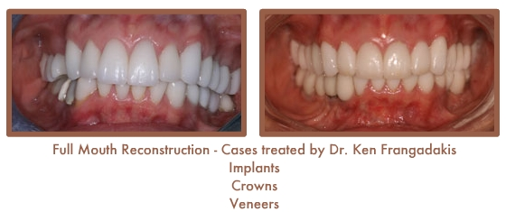 Reconstruction Case Study