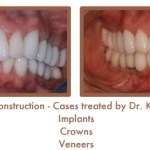 Reconstruction Case Study