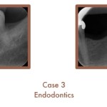Endodontics Case Study