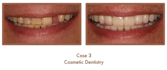 Case Study Image