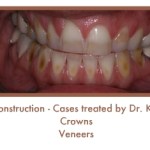 Before image