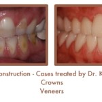 Reconstruction Case Study