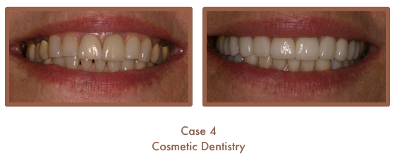 Case Study Image