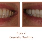 Case Study Image