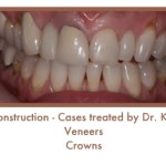 Before image