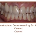 Before image