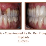 Dental implants case study image