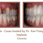 Dental implants case study image