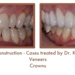 Reconstruction Case Study