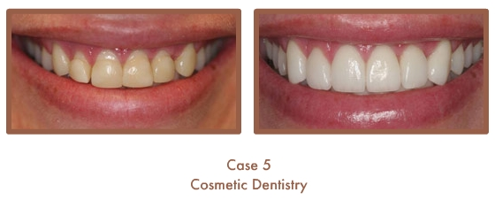 Case Study Image