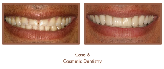 Case Study Image