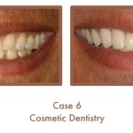 Case Study Image