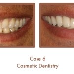 Case Study Image