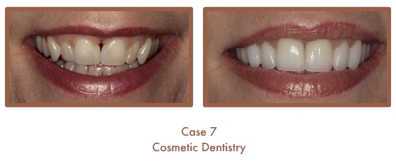 Case Study Image