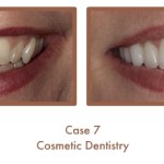 Case Study Image