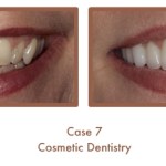 Case Study Image