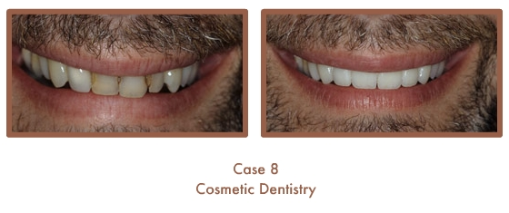 Case Study Image