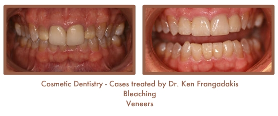 Before and After image