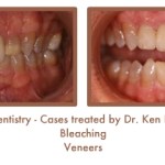 Before and After image