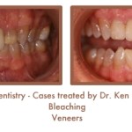 Before and After image